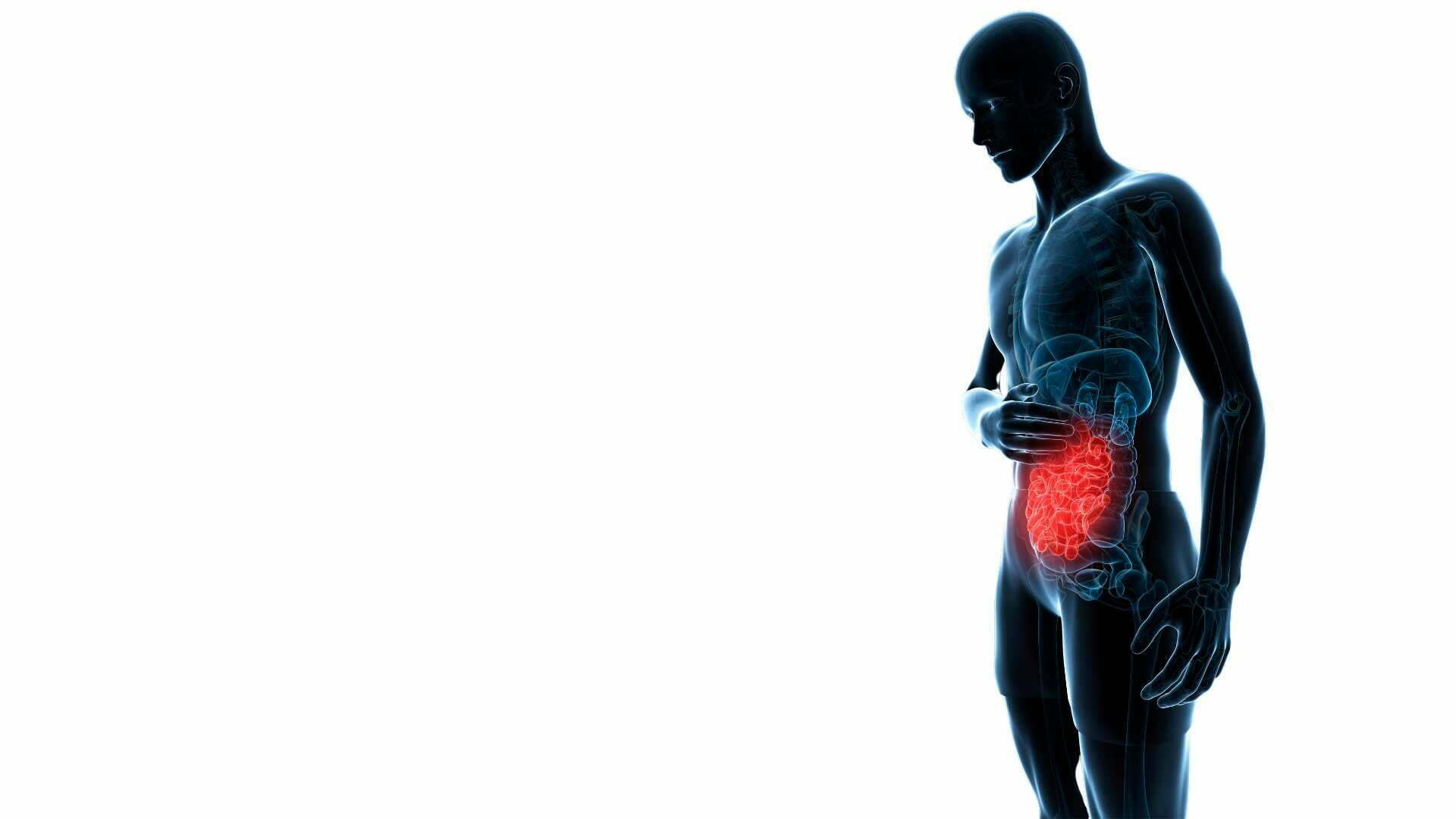 Acute Abdominal Pain